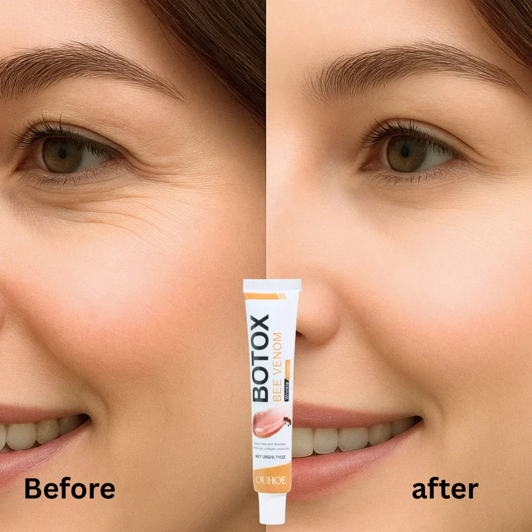 OUHOE - Bee Venom Botox Wrinkle Cream