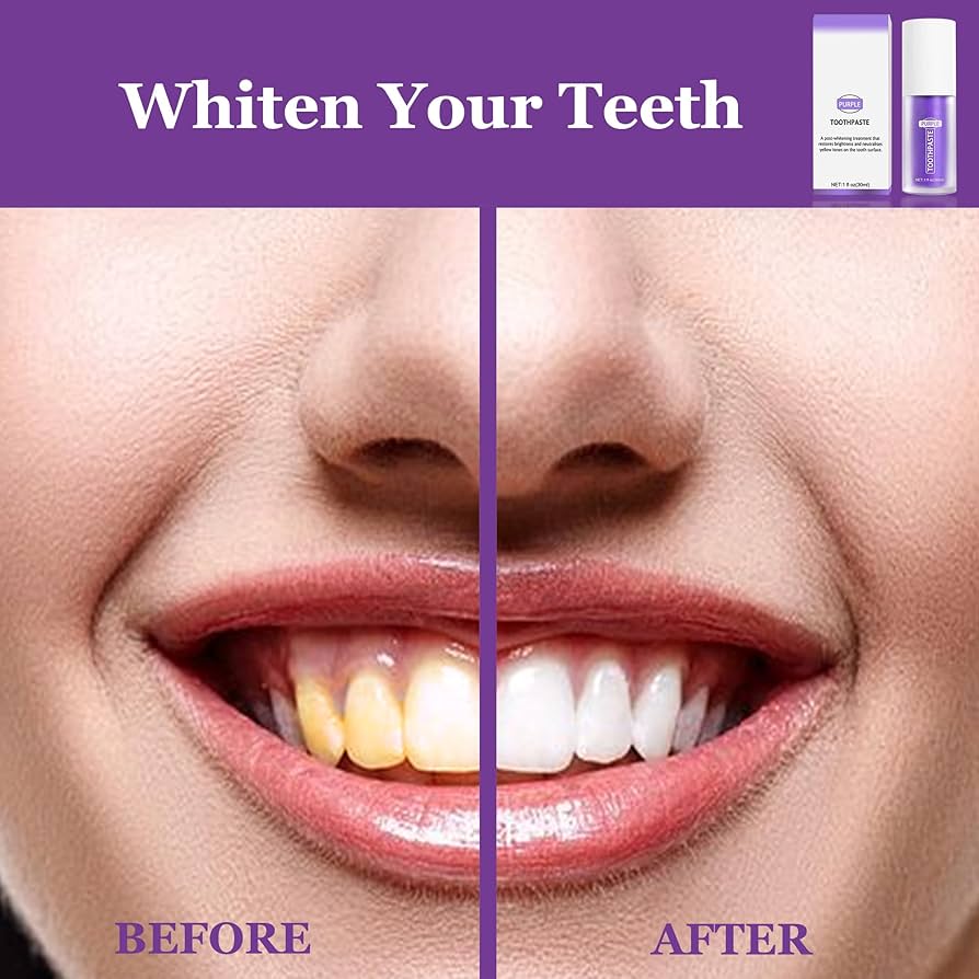 Purple Whitening Toothpaste